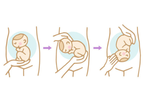 藤本美貴が１日入院して受けた 外回転術 リスクは Tv 日常のいろいろネタ帳